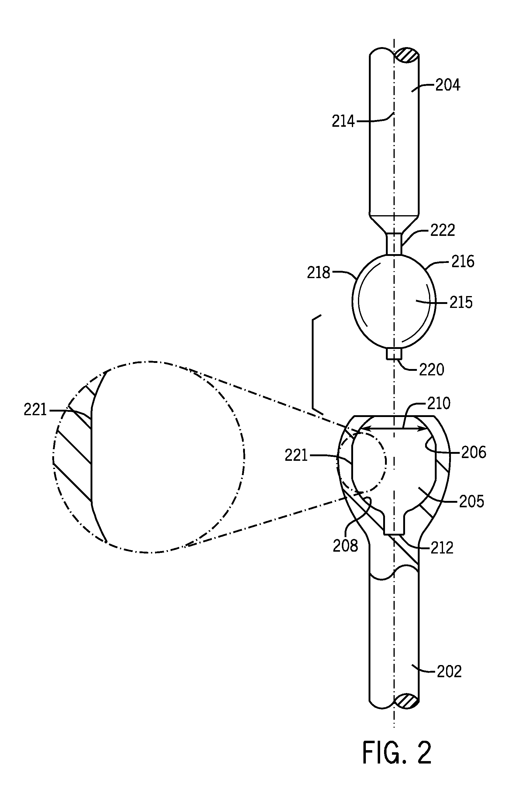 Spinal stabilization systems