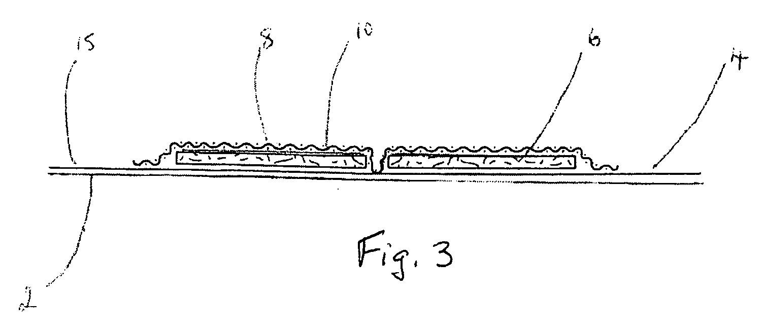 Wound dressing