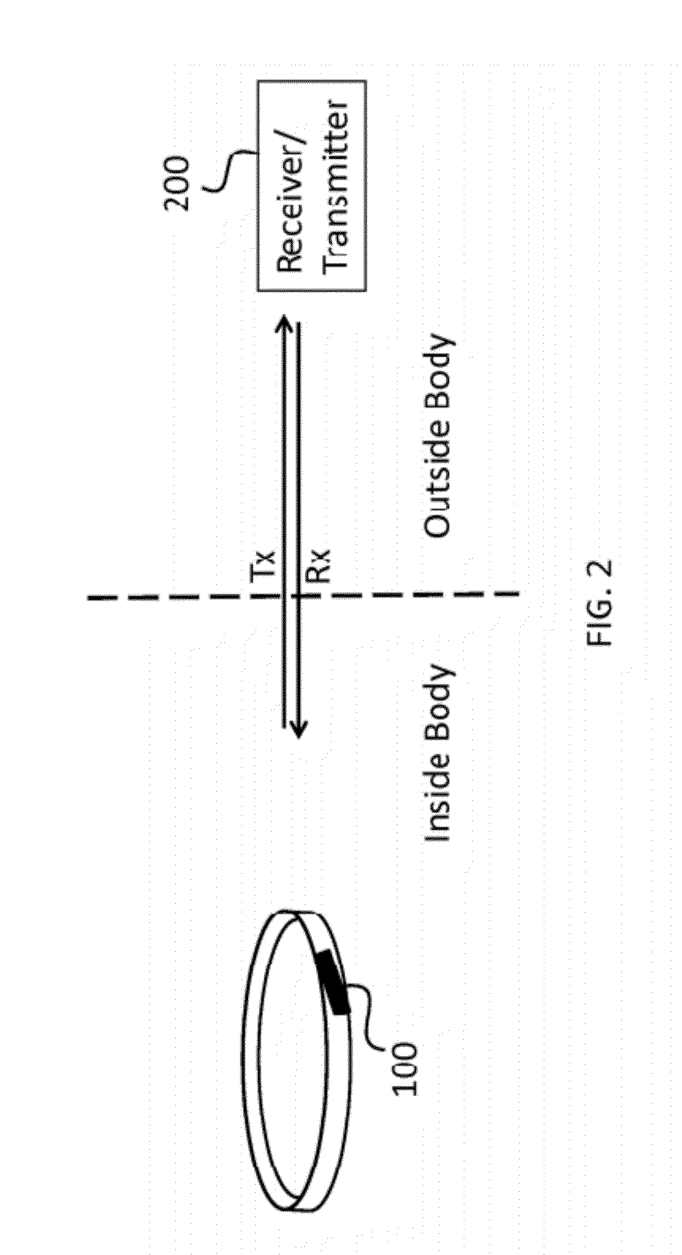 Wireless hemodynamic monitoring system integrated with implantable heart valves