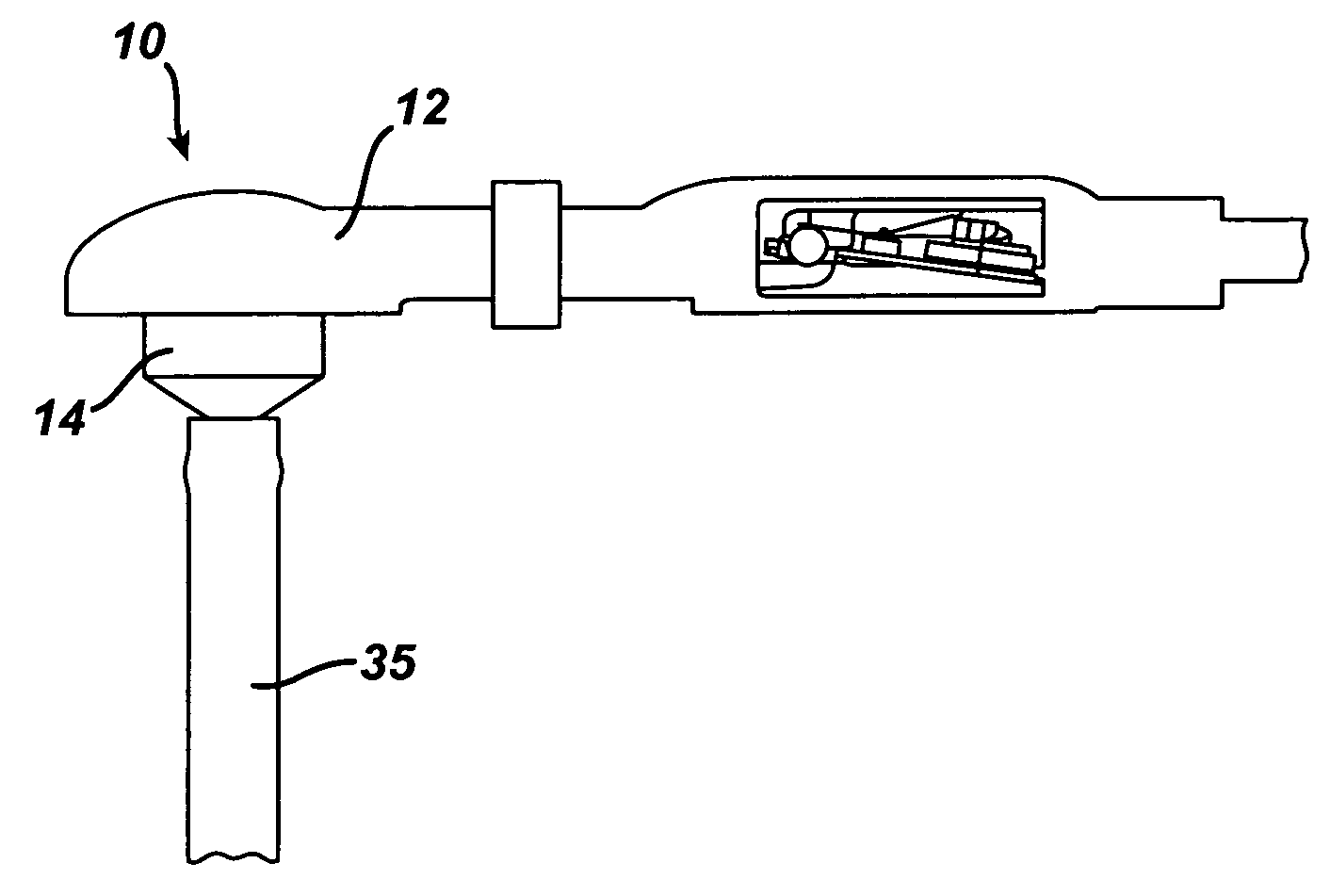 Ventriculostomy reservoir