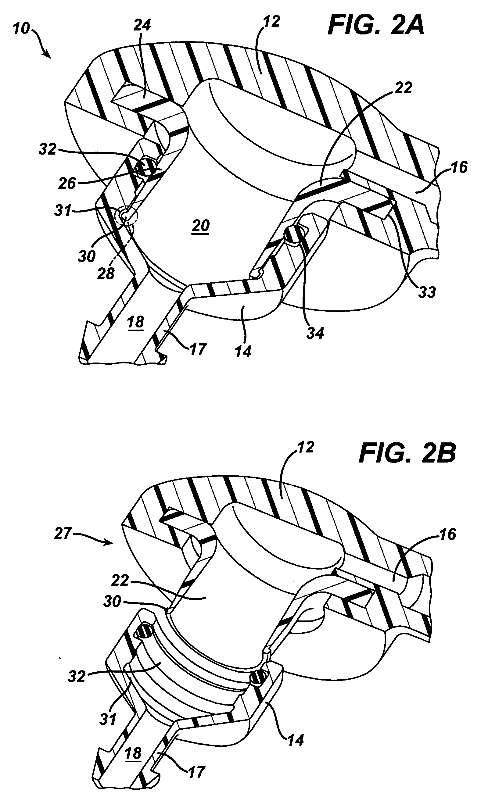 Ventriculostomy reservoir