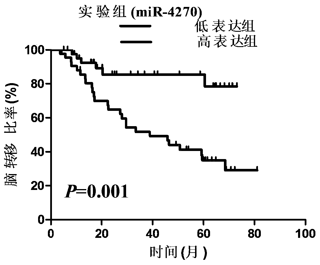 Molecular marker mir-4270 for predicting lung cancer brain metastases and its application in drugs and diagnostic kits