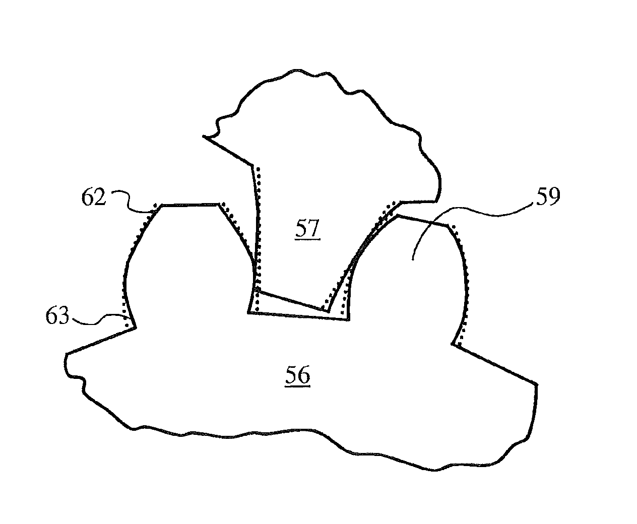 Full traction differential with hybrid gearing