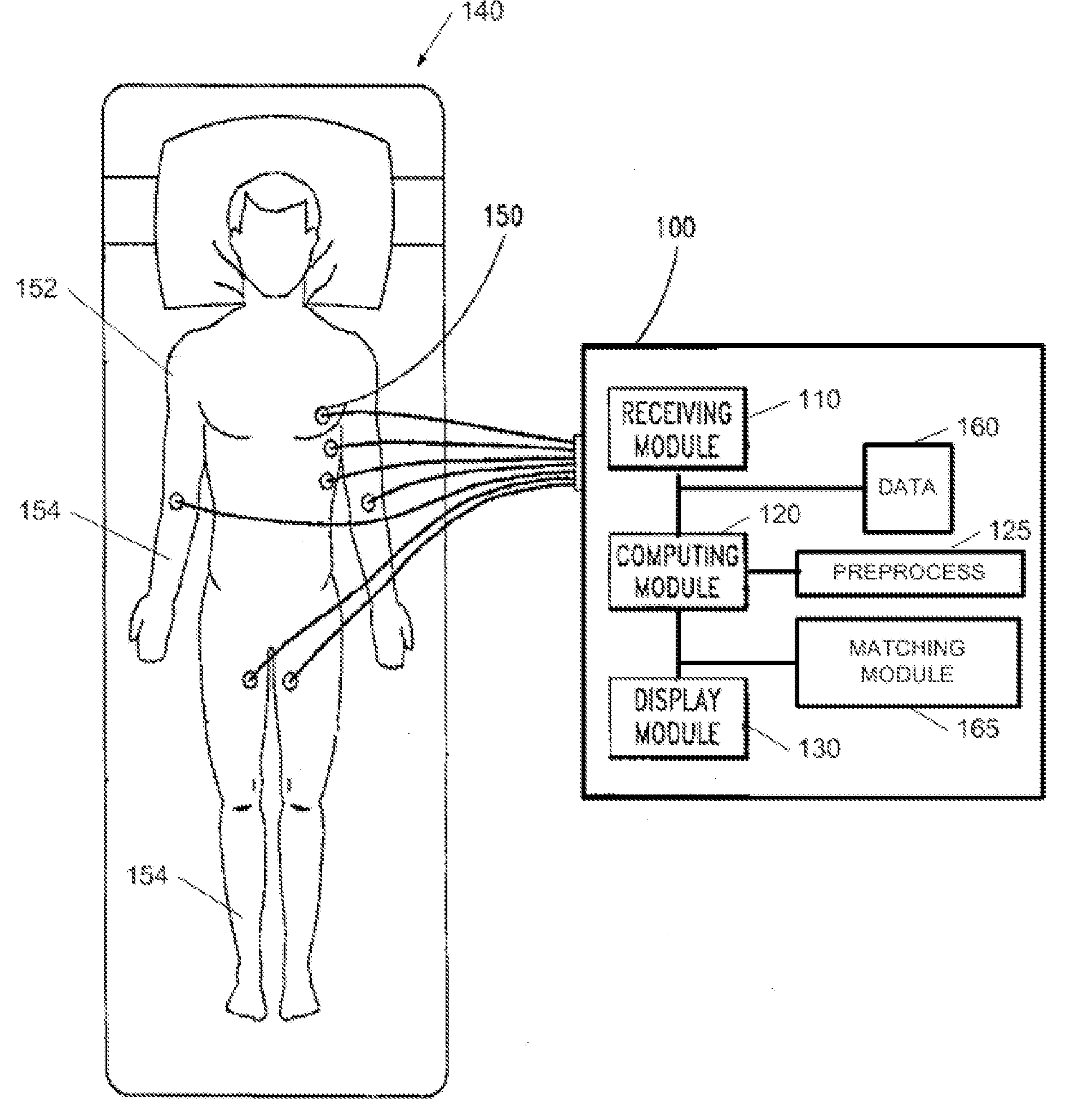 Device and method for detecting cardiac impairments