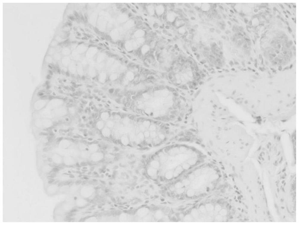 Establishment and evaluation method of animal model for drug in vivo process evaluation after intraperitoneal radiotherapy