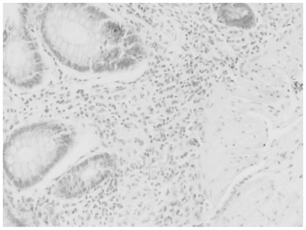 Establishment and evaluation method of animal model for drug in vivo process evaluation after intraperitoneal radiotherapy