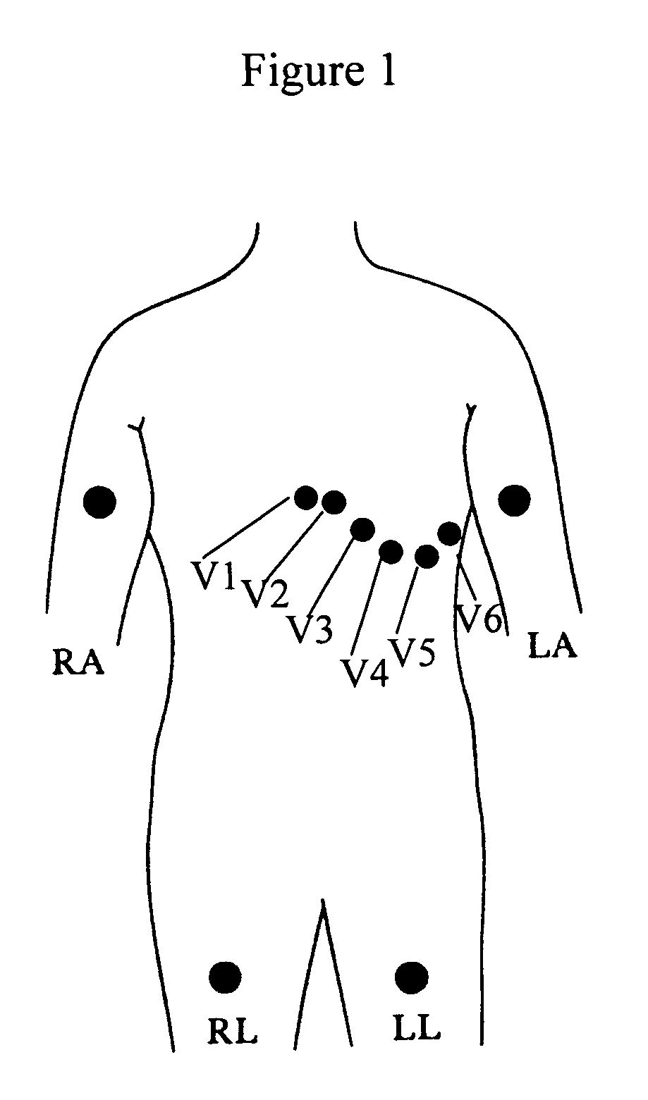 Floating physiological data acquisition system with expandable ECG and EEG