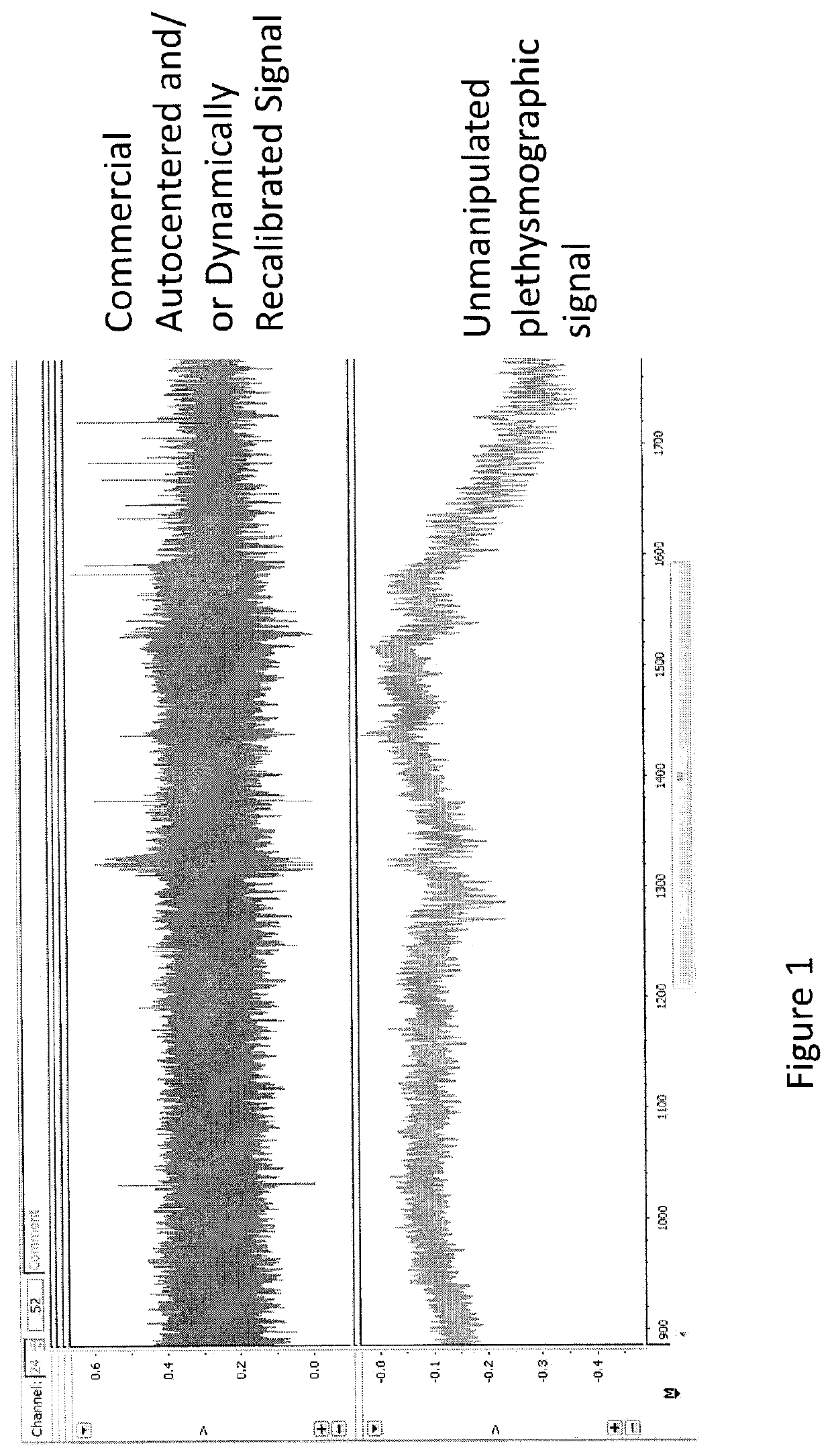 Method and system enabling photoplethysmograph measurement of volume status