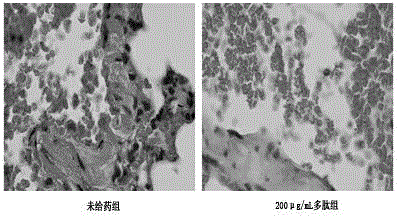 Application of polypeptide in treatment of diabetes