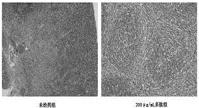 Application of polypeptide in treatment of diabetes