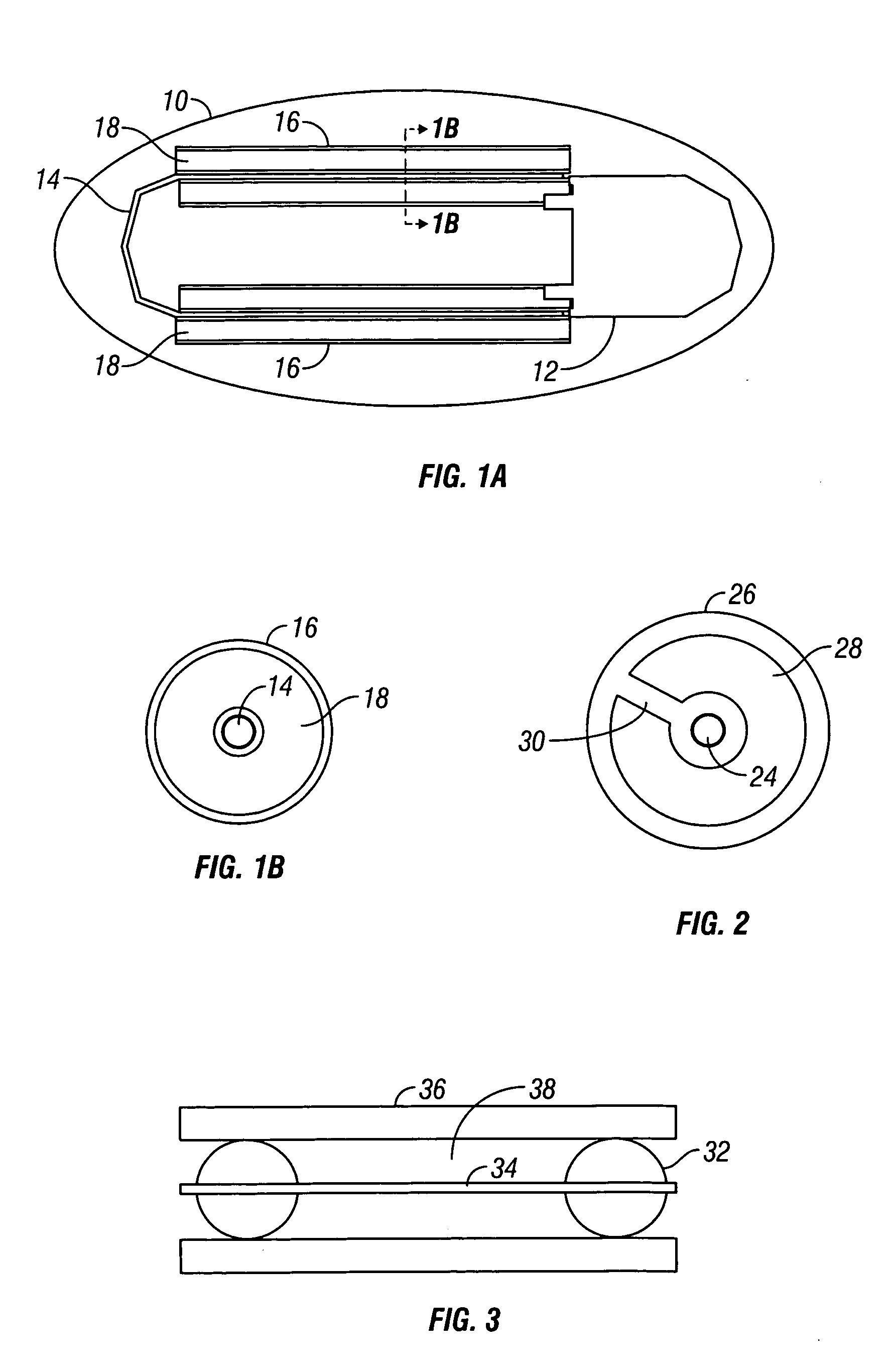 Implantable device with improved radio frequency capabilities