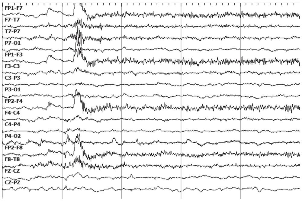 Motor imagery analysis method and system based on EEG brain-computer interface