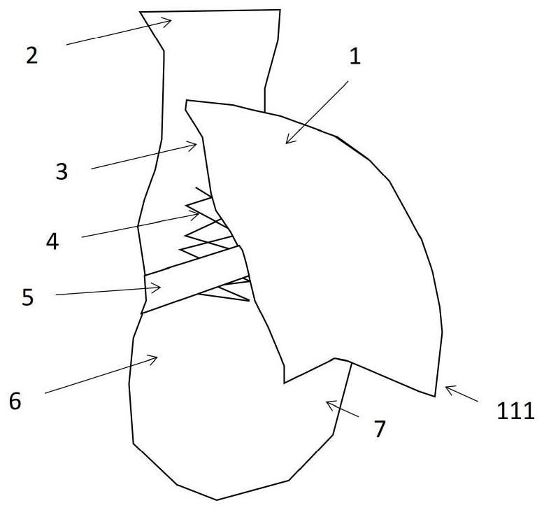 Mechanical supporting device and method for preventing ankle movement sprain