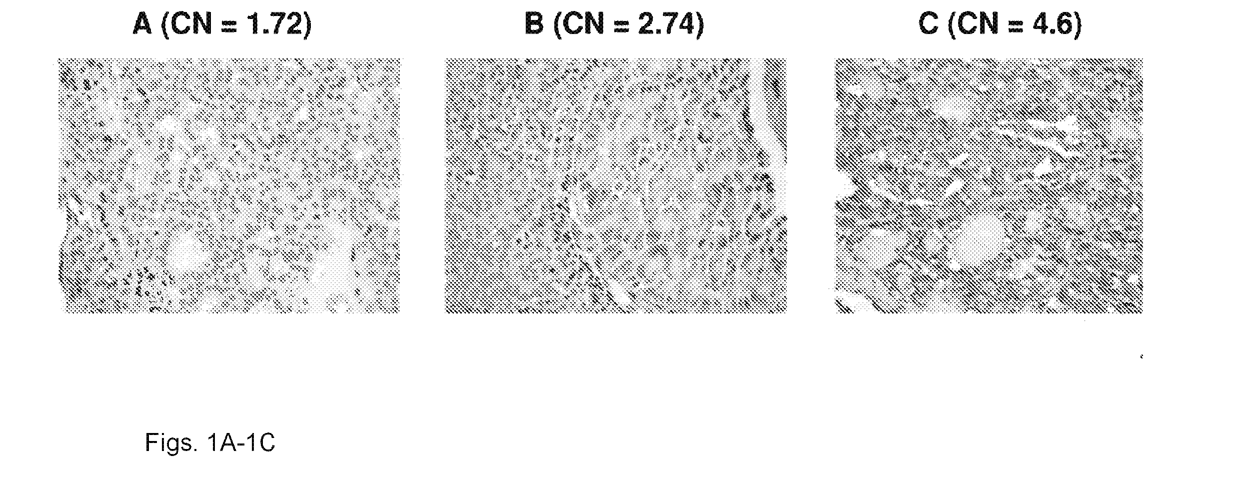 Genetic amplification of iqgapi in cancer