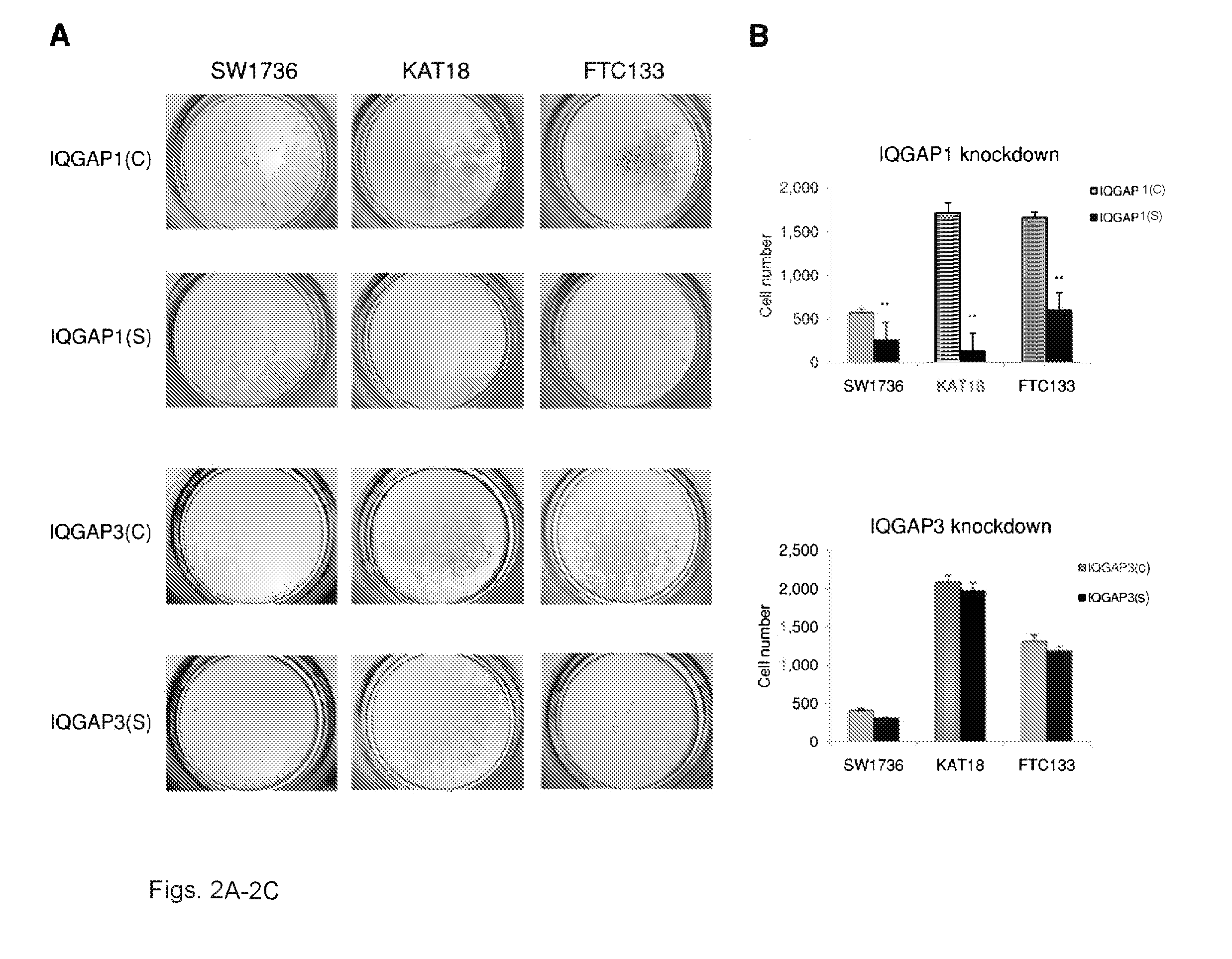 Genetic amplification of iqgapi in cancer