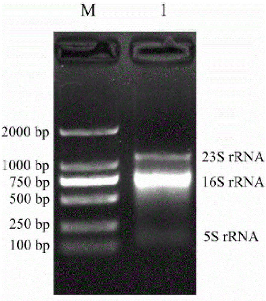 Method and kit for detecting food-borne pathogenic bacteria based on nasba test strips