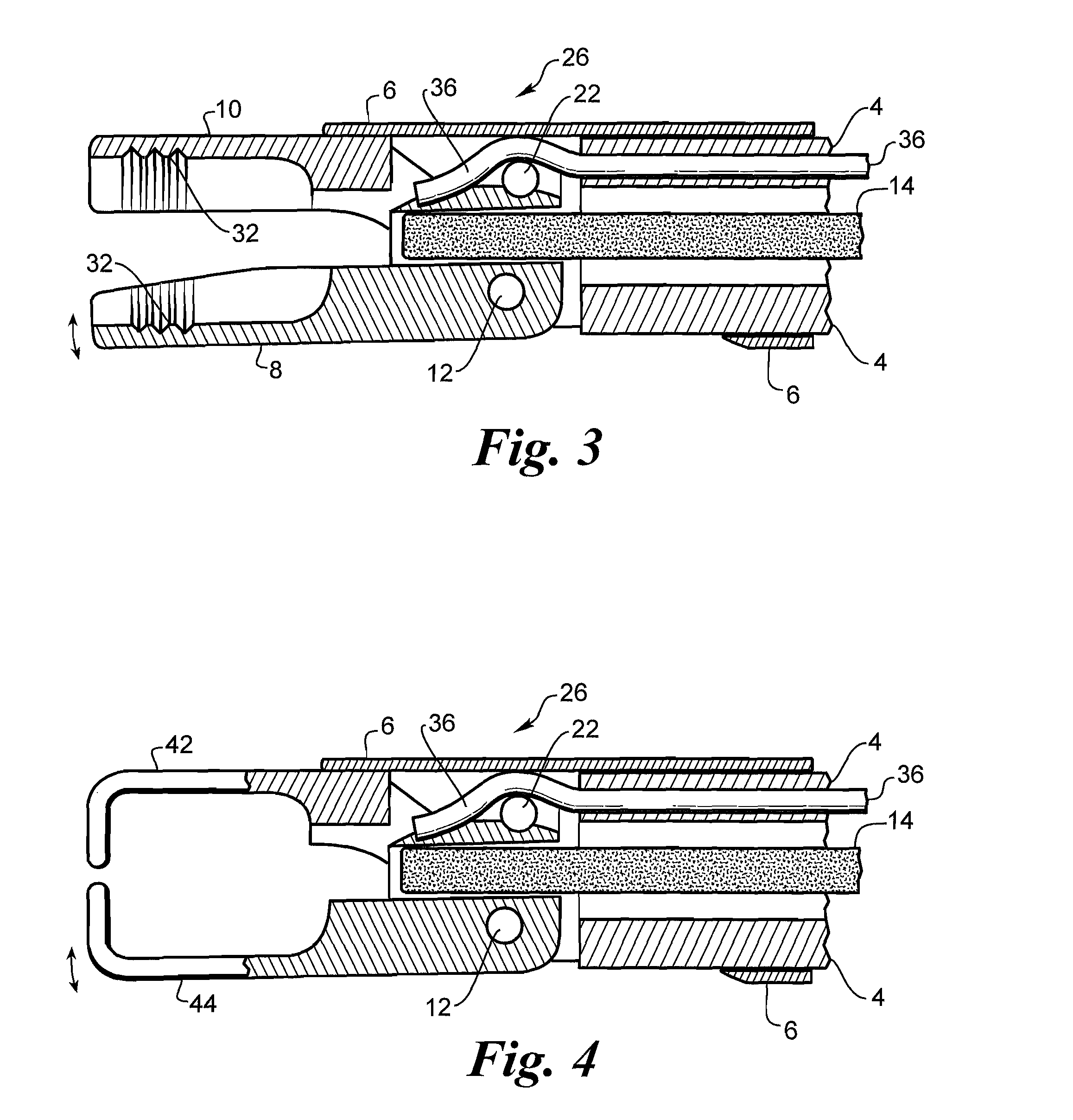 Medical device extraction tool