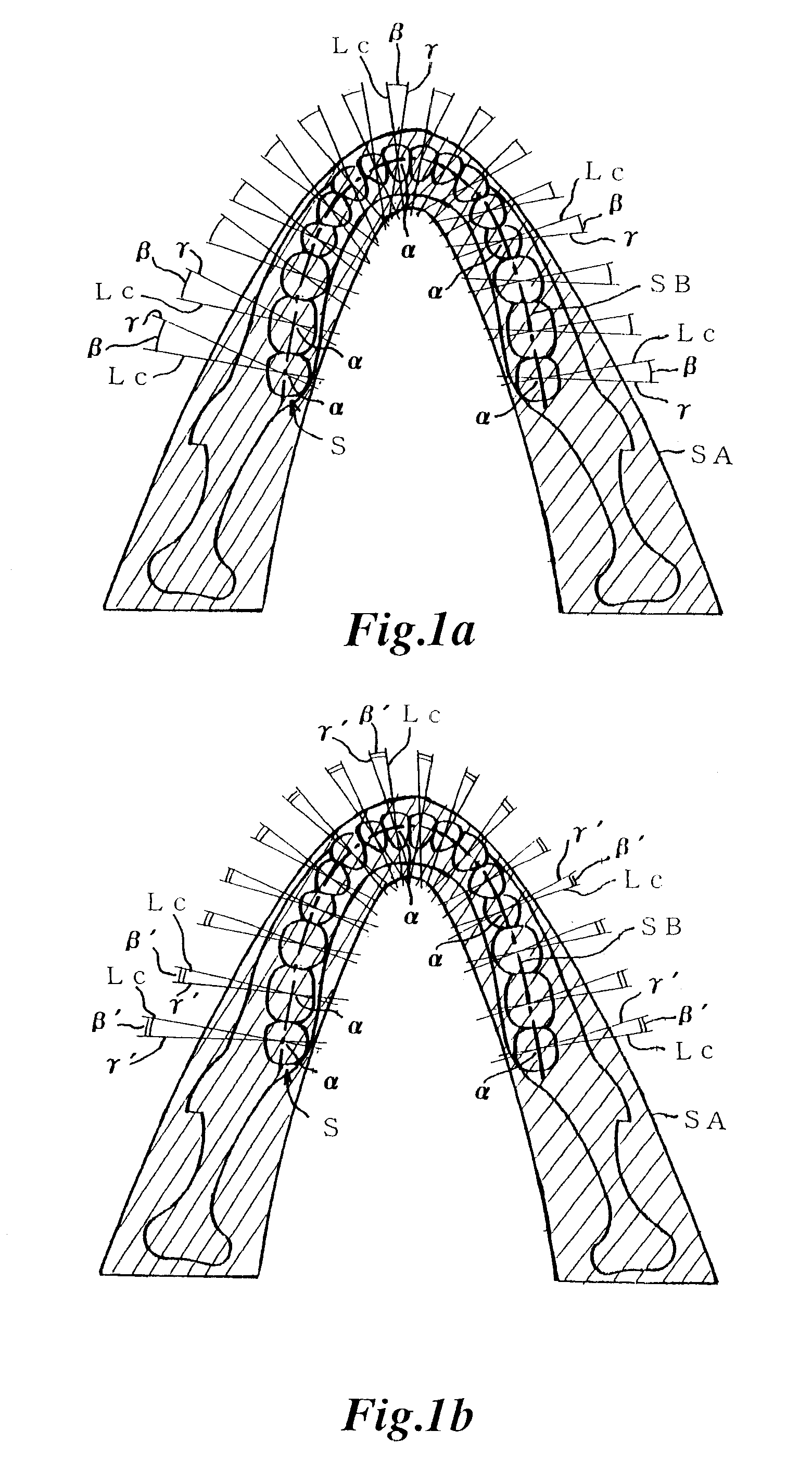 X-ray computed tomography method and apparatus