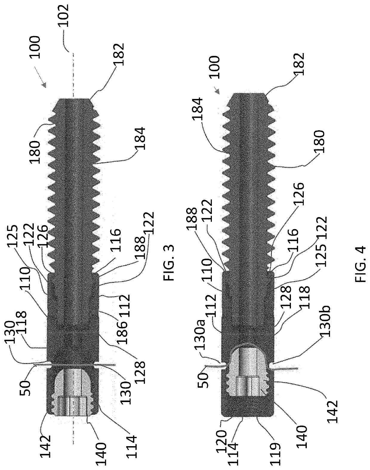 Syndesmosis Fixation Assembly