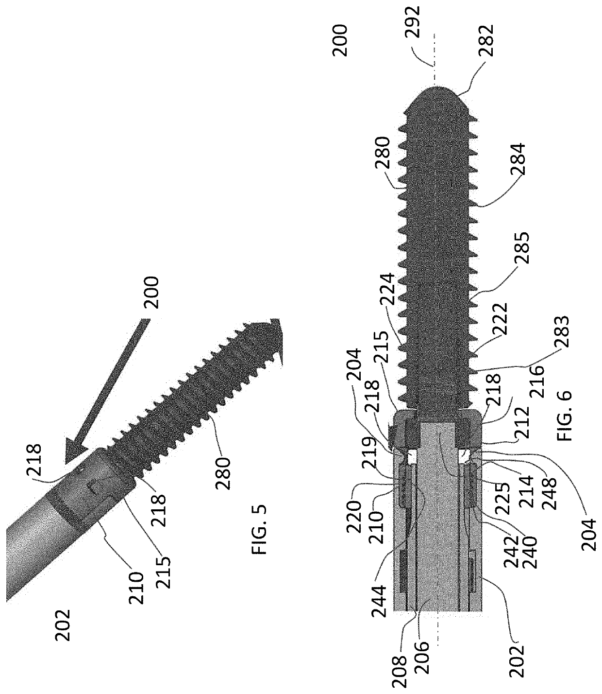 Syndesmosis Fixation Assembly