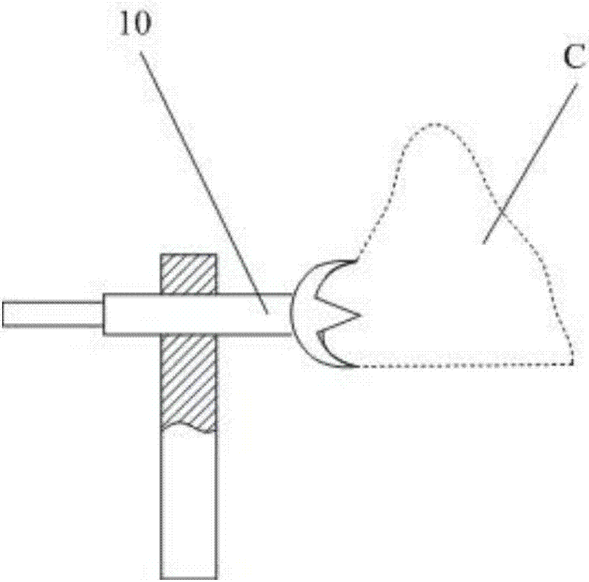 Distal femoral rotary positioner