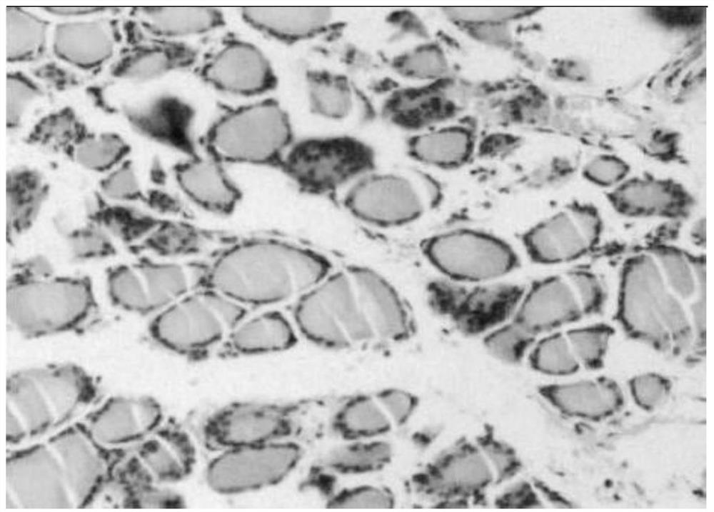 Use of pyrazolopyrimidine derivatives in the treatment of autoimmune thyroid disease