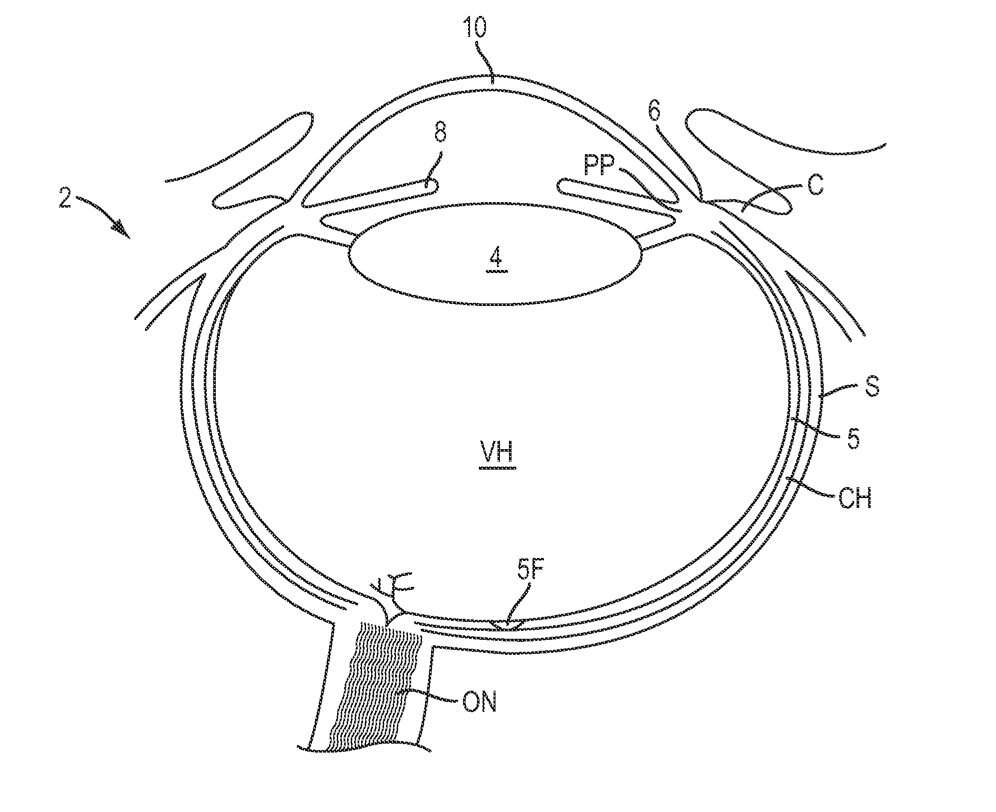 Contact lenses for refractive correction