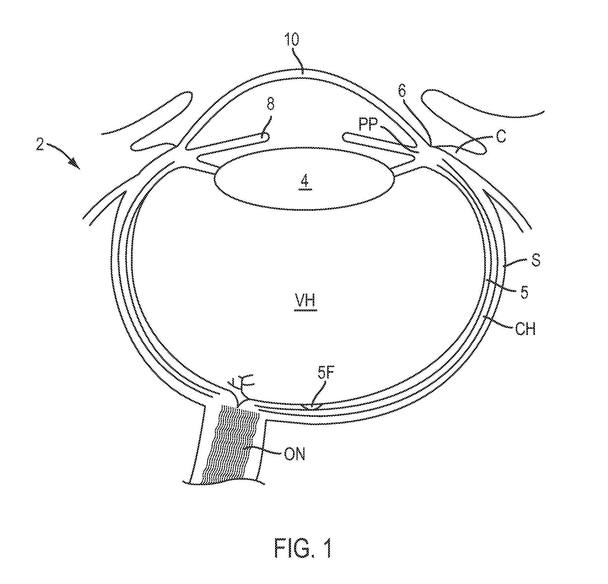 Contact lenses for refractive correction