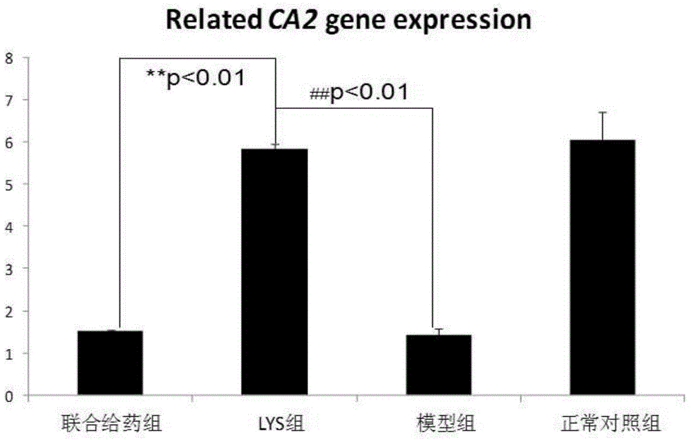 Application of chlorogenic acid in preparation of medicines for treating osteopetrosis