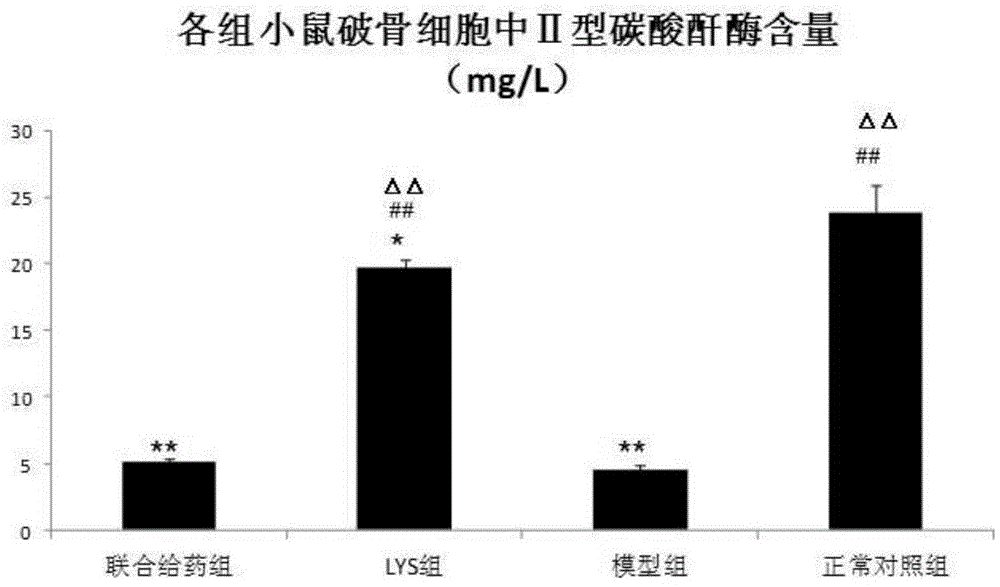 Application of chlorogenic acid in preparation of medicines for treating osteopetrosis