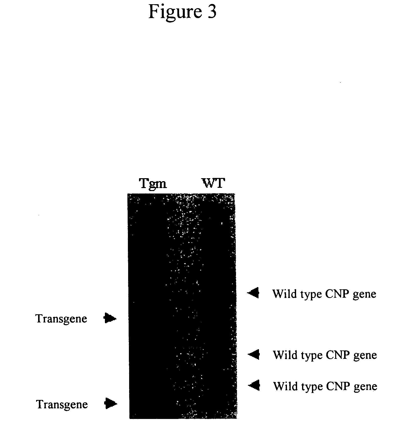 Theurapeutic or prophyiactic agent for arthritis