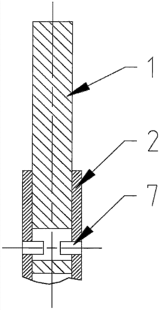 Elastic spine fixing system and pressure-adjustable fixing rods