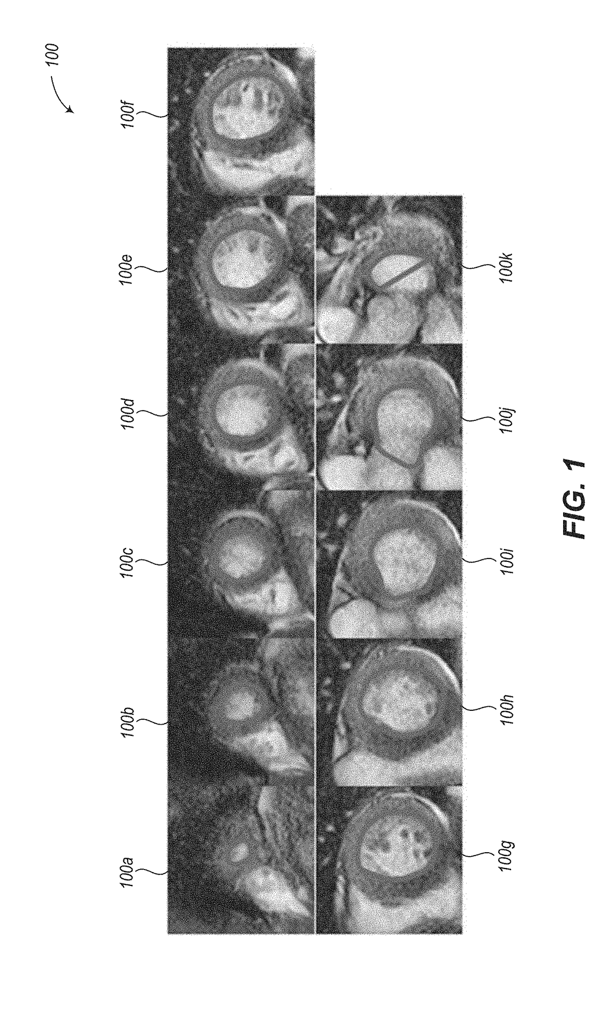 Automated segmentation utilizing fully convolutional networks