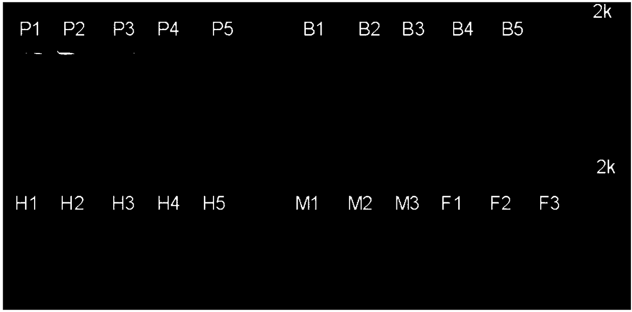 Primer for detecting pseudomonas syringae pv.actinidae of kiwifruit as well as detection method and application thereof