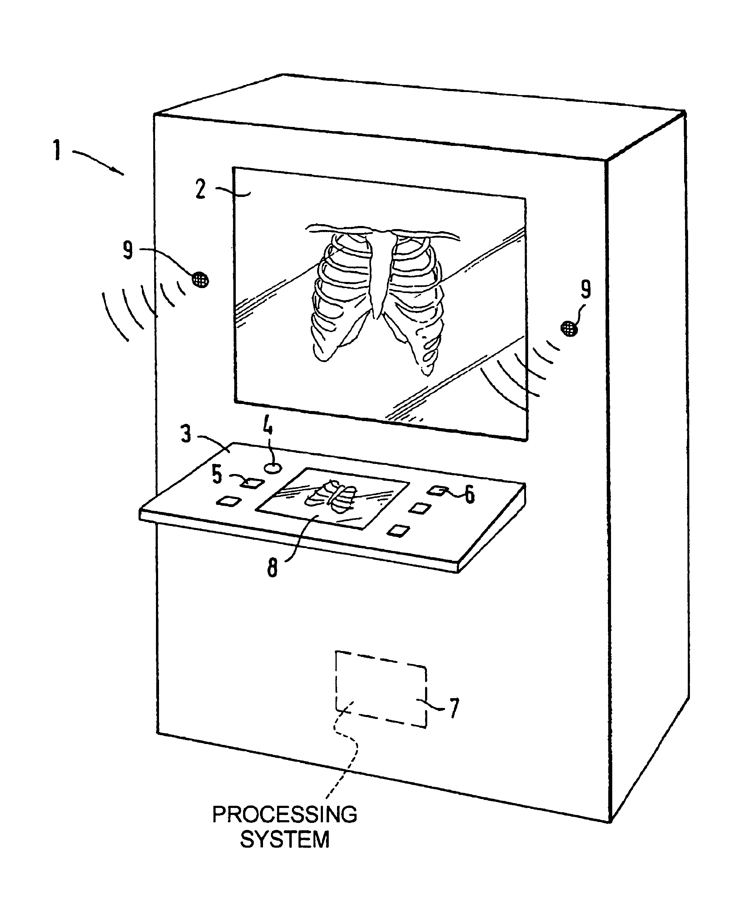 Method and apparatus for evaluating medical examination images