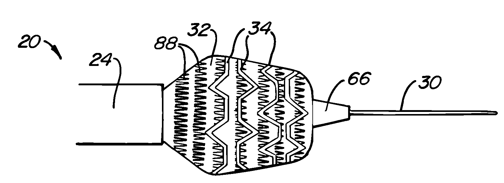 Stent deployment systems and methods