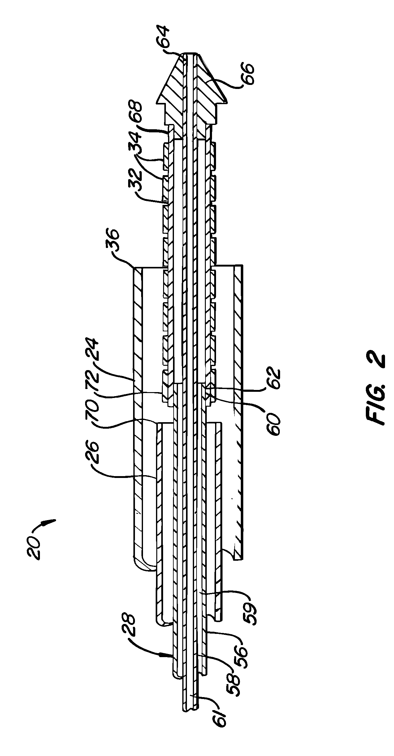 Stent deployment systems and methods