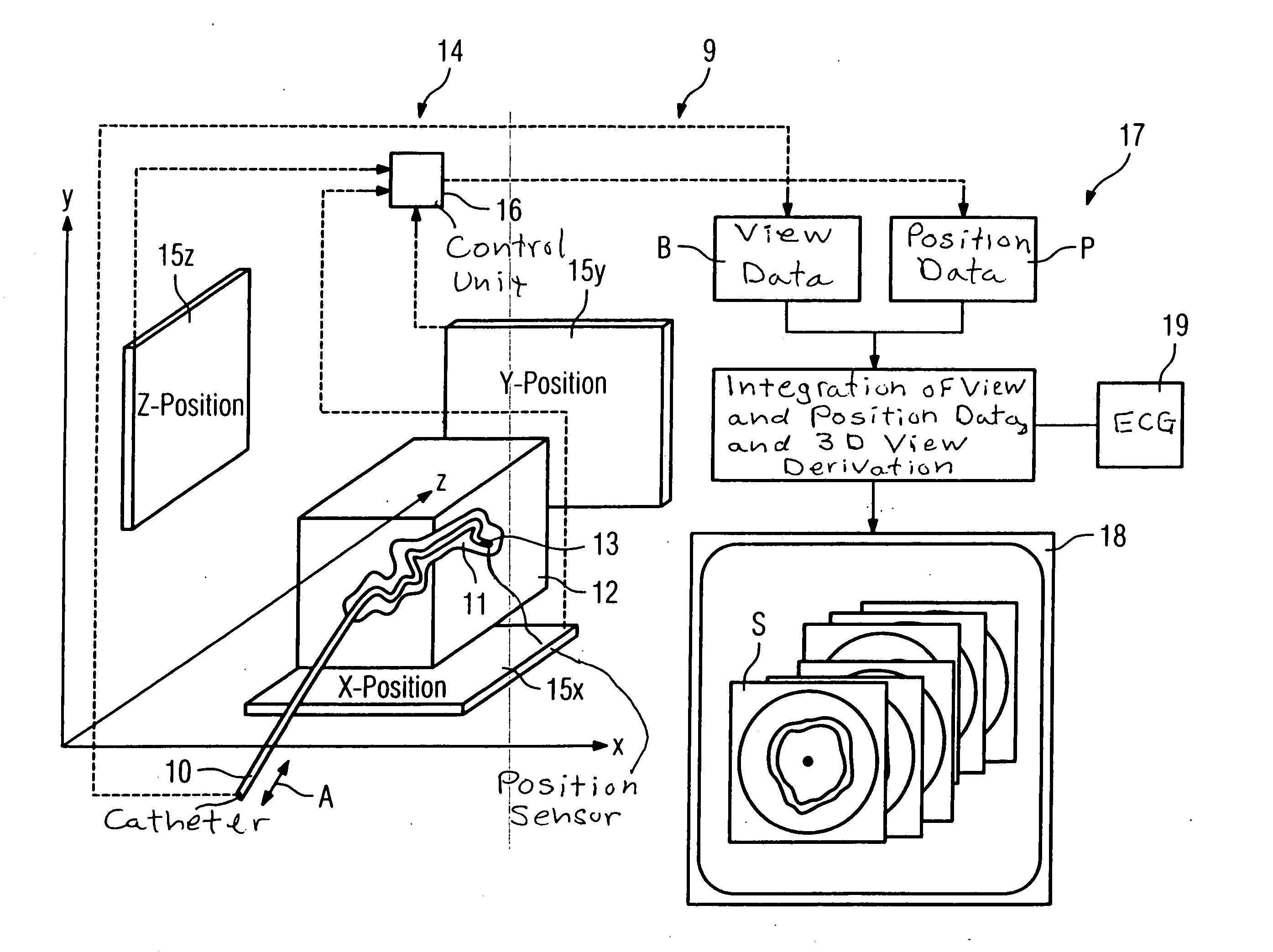 Optical coherence tomography system for the examination of human or animal tissue or of organs