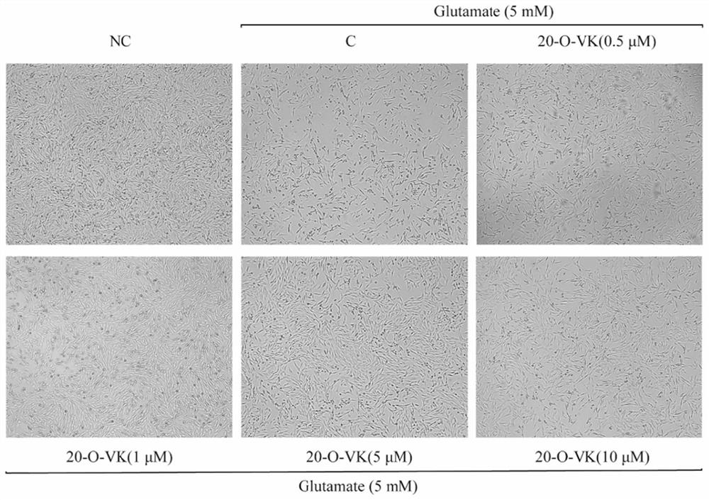 A kind of pharmaceutical composition comprising c21 steroid saponin and application thereof