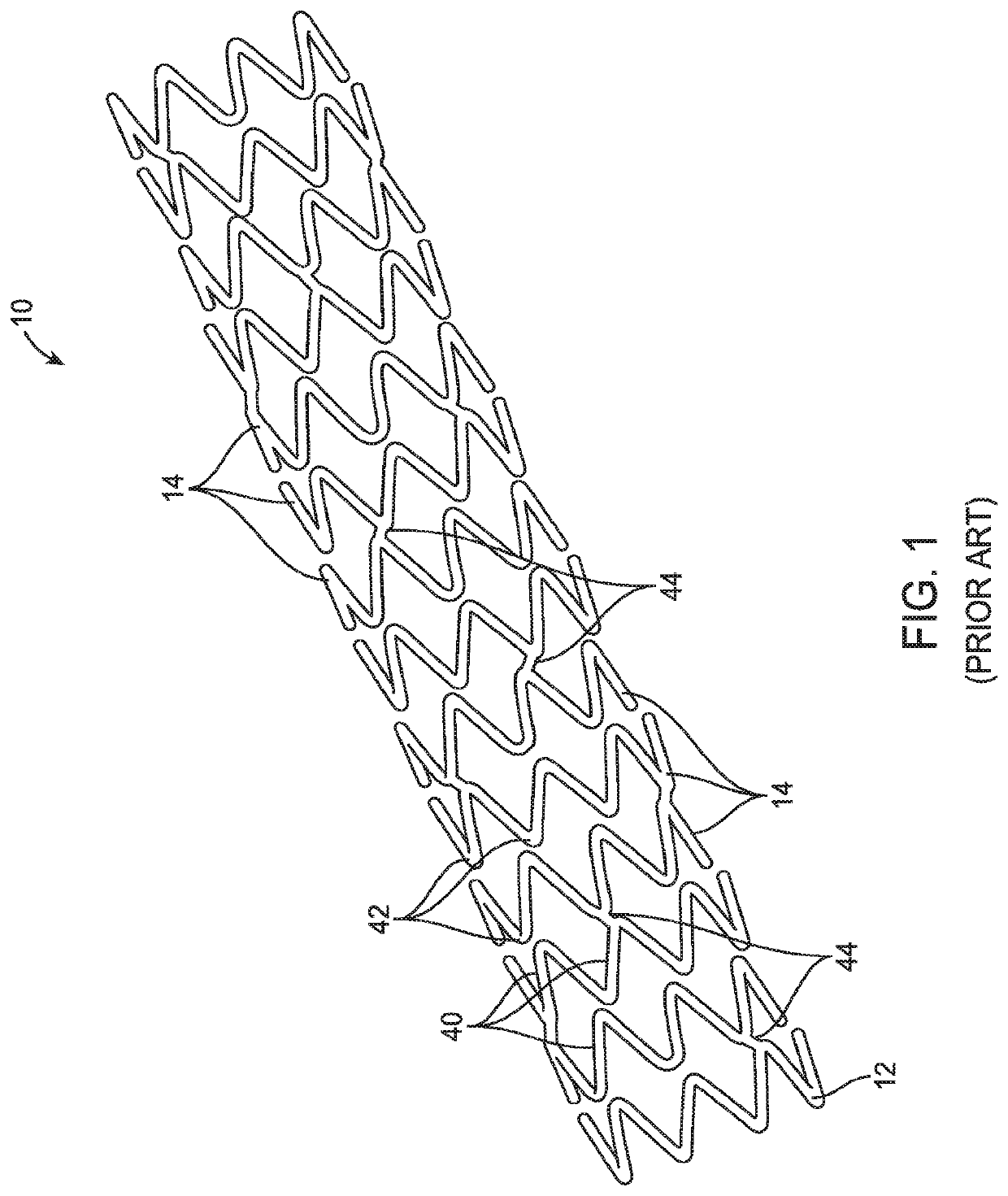 Uncaging stent