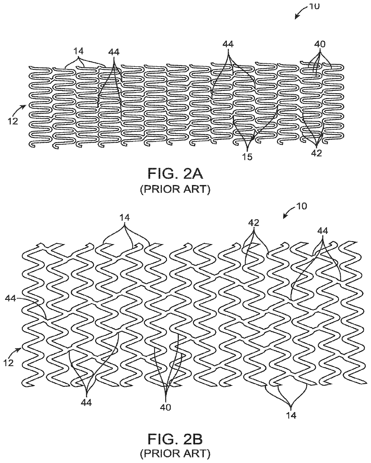 Uncaging stent