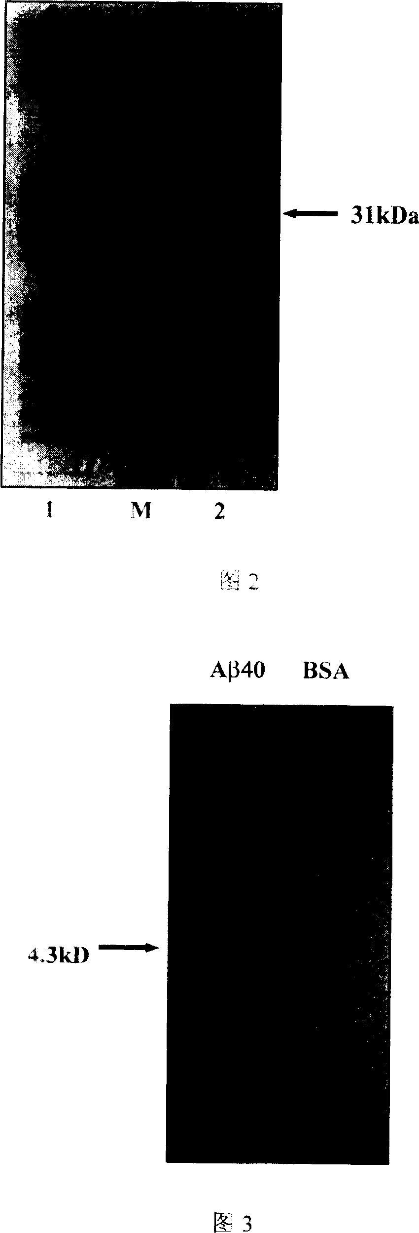 Antibody for treating or preventing senile dementia, its expression vector and application in drug preparation