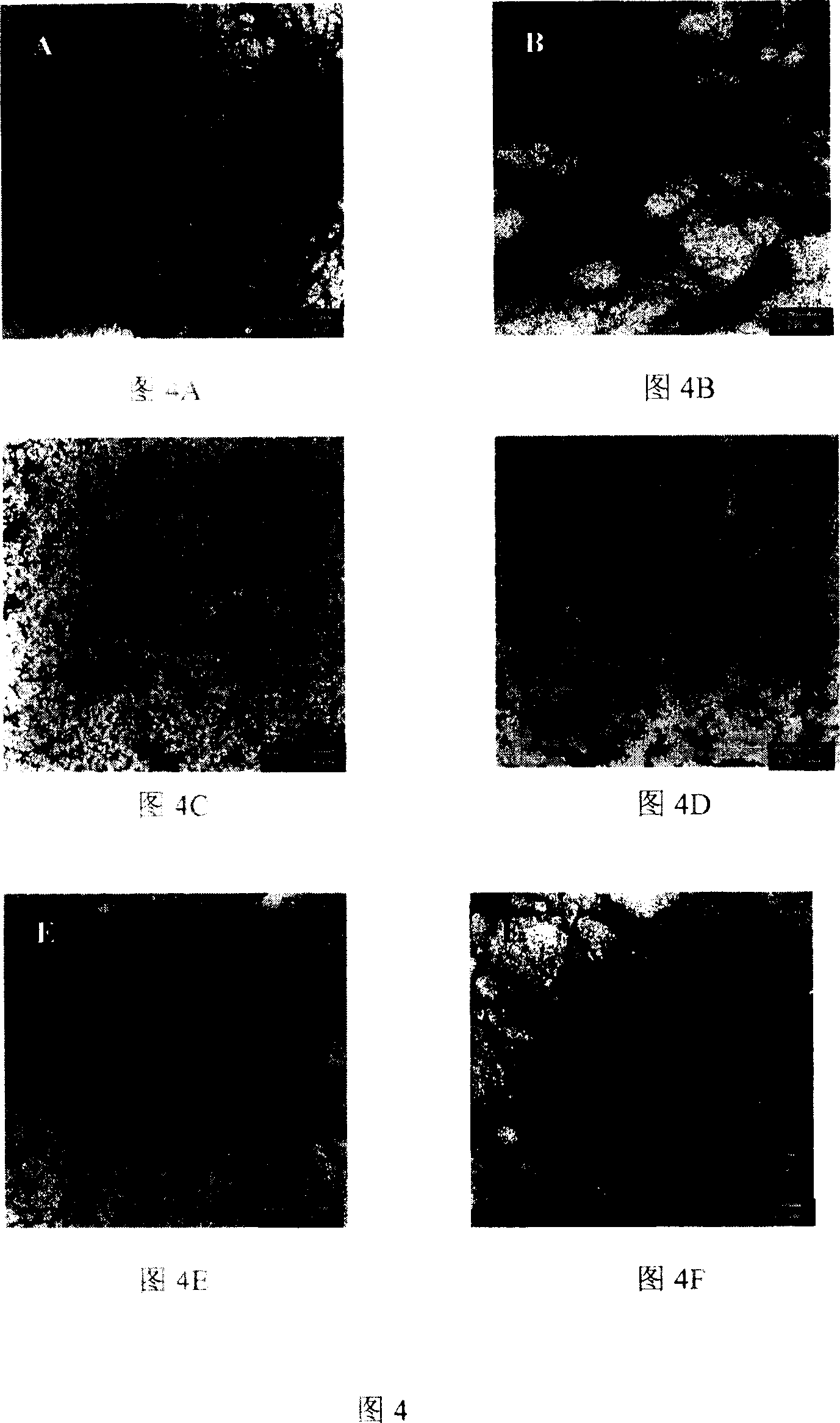 Antibody for treating or preventing senile dementia, its expression vector and application in drug preparation