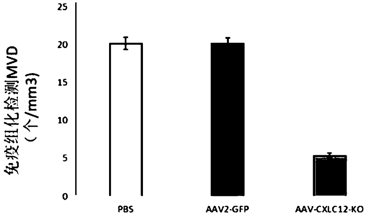 Adeno-associated virus recombinant vector for knocking out CXCL12 gene and construction method and use thereof