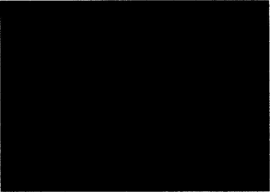 Method of differentiating human bone marrow matrix stem cell to form insulin cell