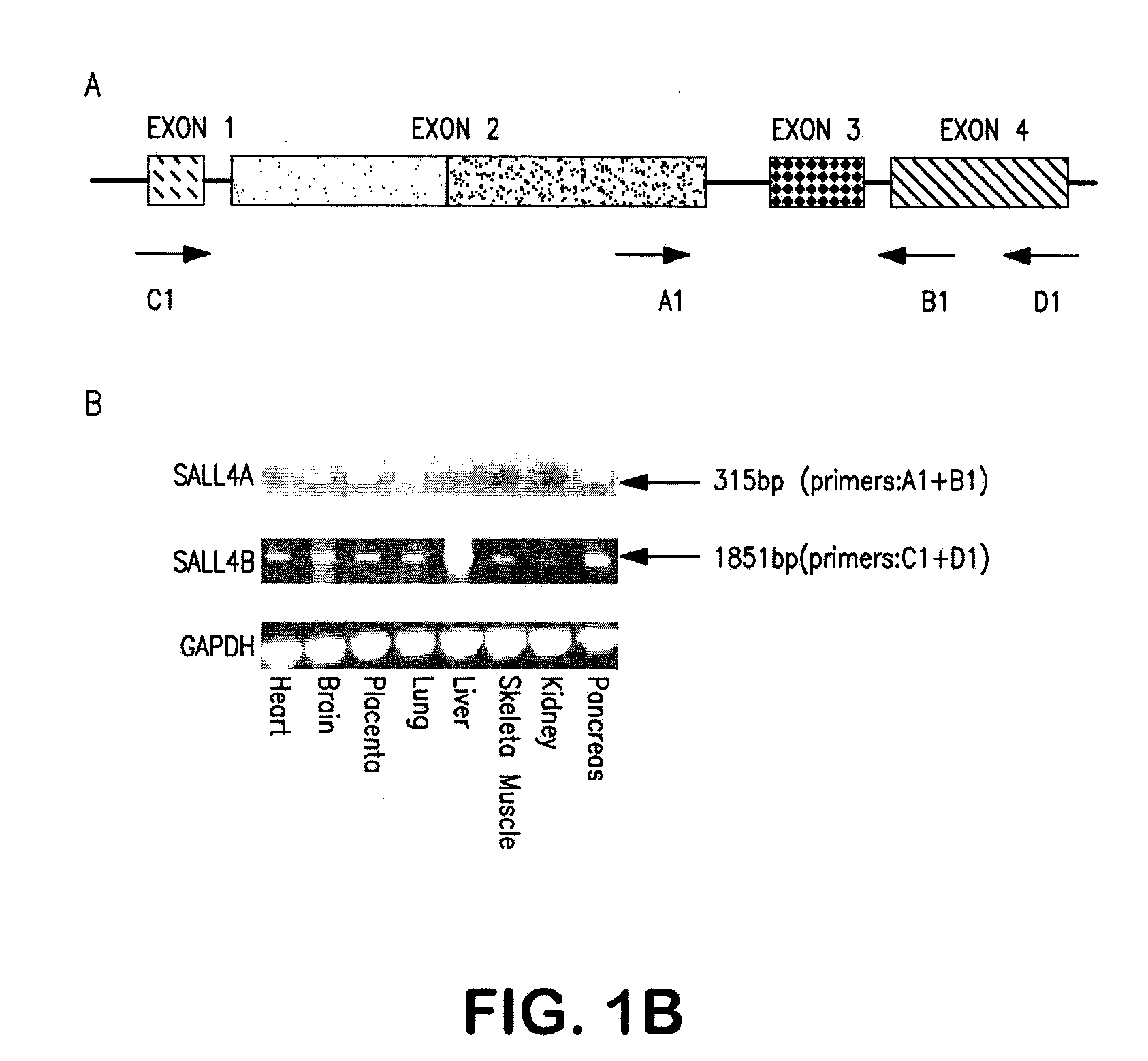 Targeting of sall4 for the treatment and diagnosis of proliferative disorders associated with myelodysplastic syndrome (MDS)