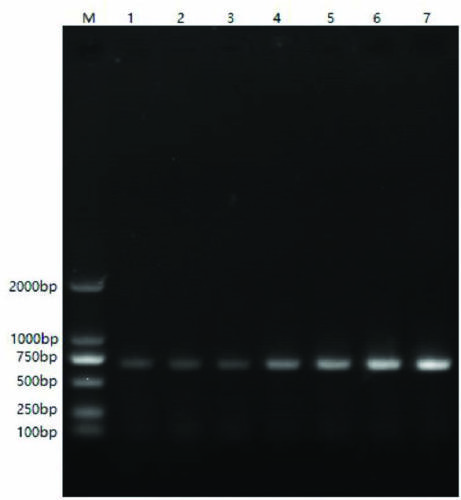 A kit for detecting bovine circovirus and a RT-PCR detection method