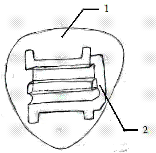 Double-wire straight wire arch correction device and tooth correcting method