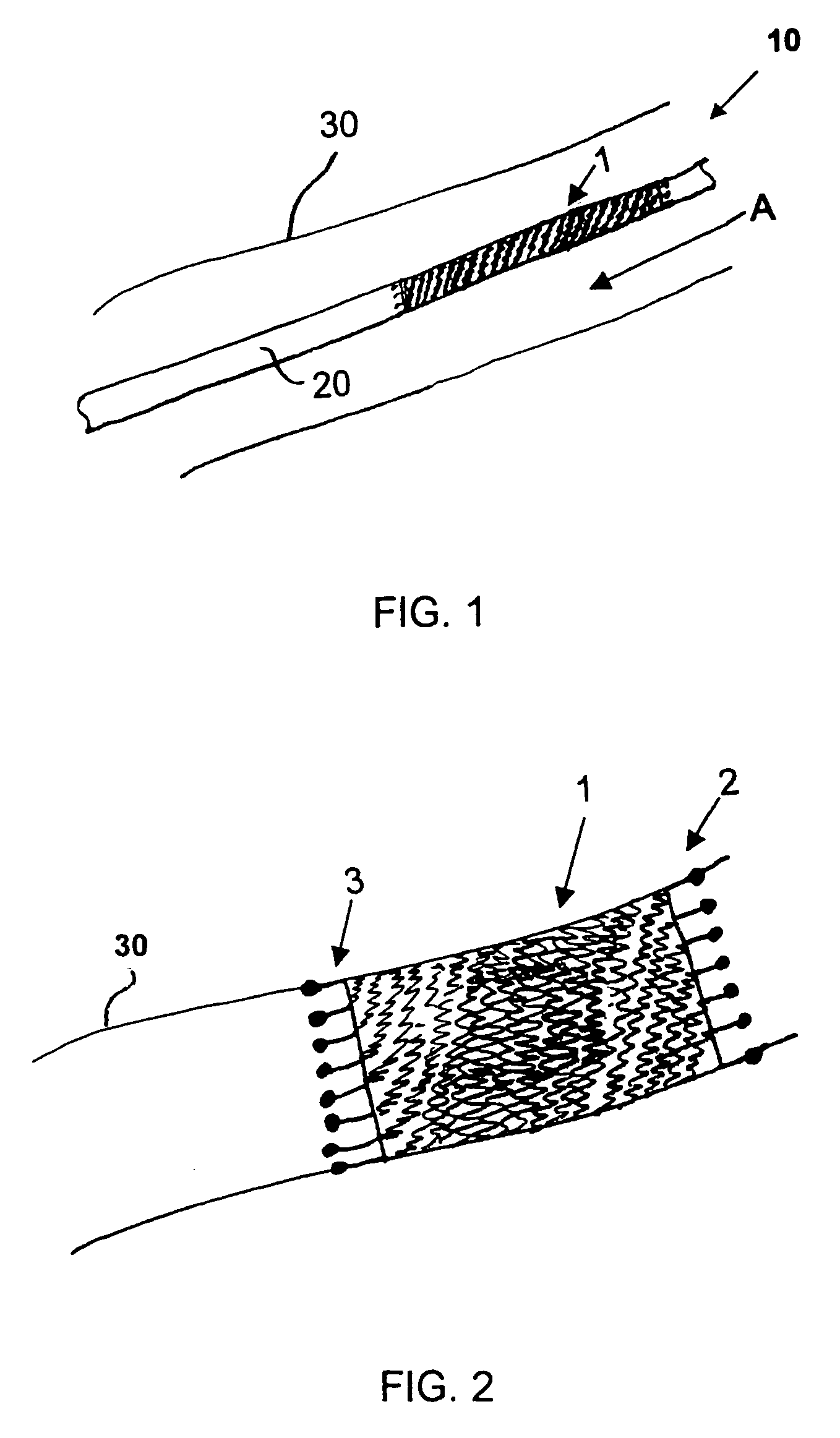 Stent and method for manufacturing the stent