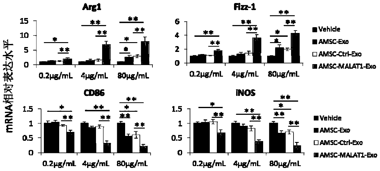 Application of AMSC-MALAT1-Exo to preparation of medicine for treating hepatic diseases and preparation method of AMSC-MALAT1-Exo